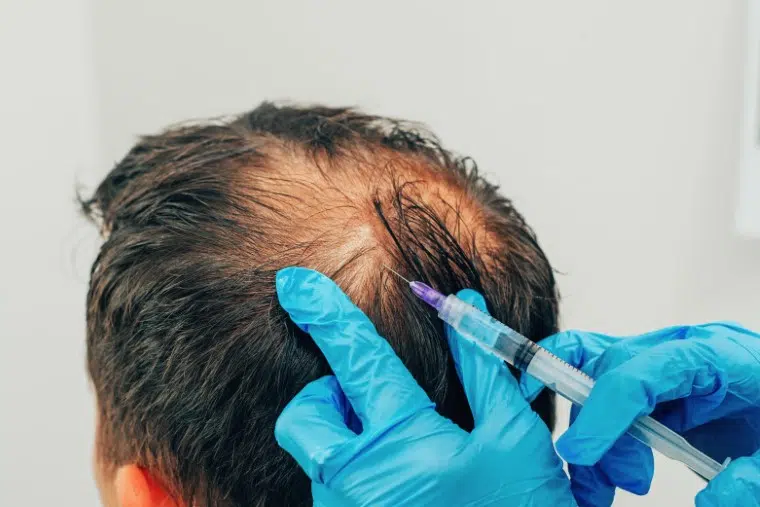 Hair transplant clinic services